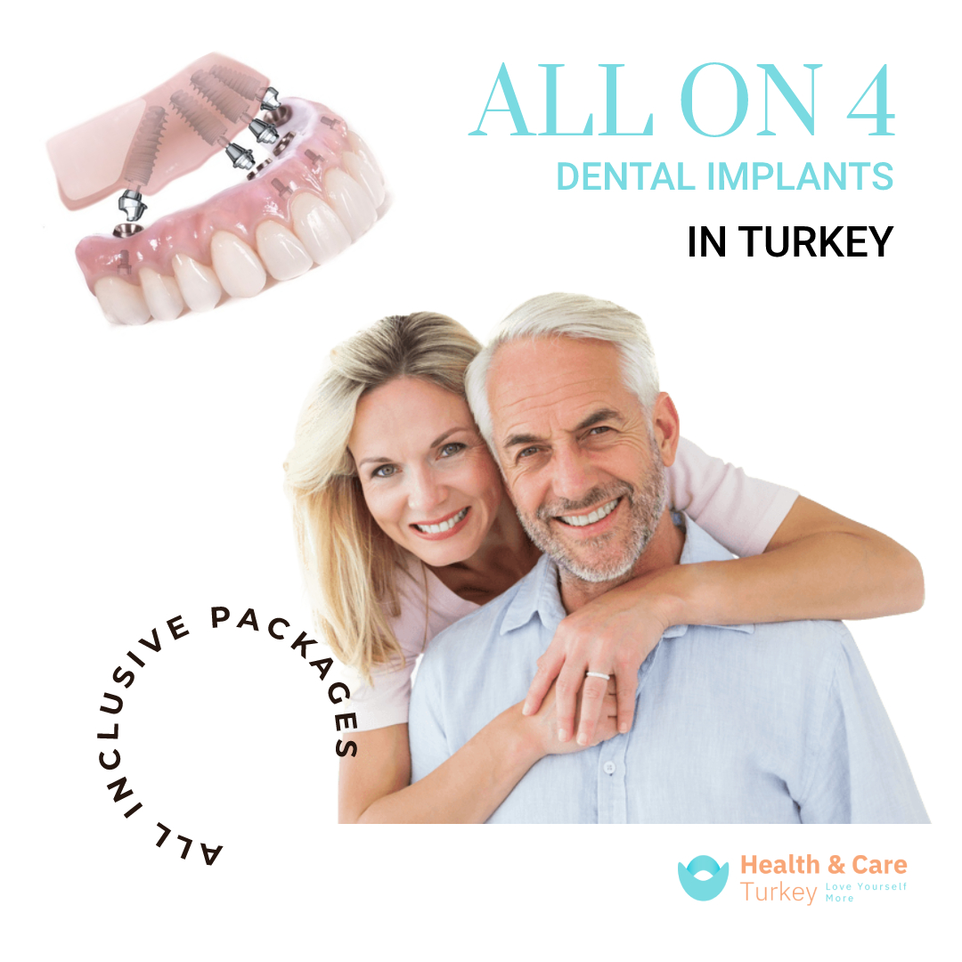 All On Dental Implants In Turkey All Inclusive Packages