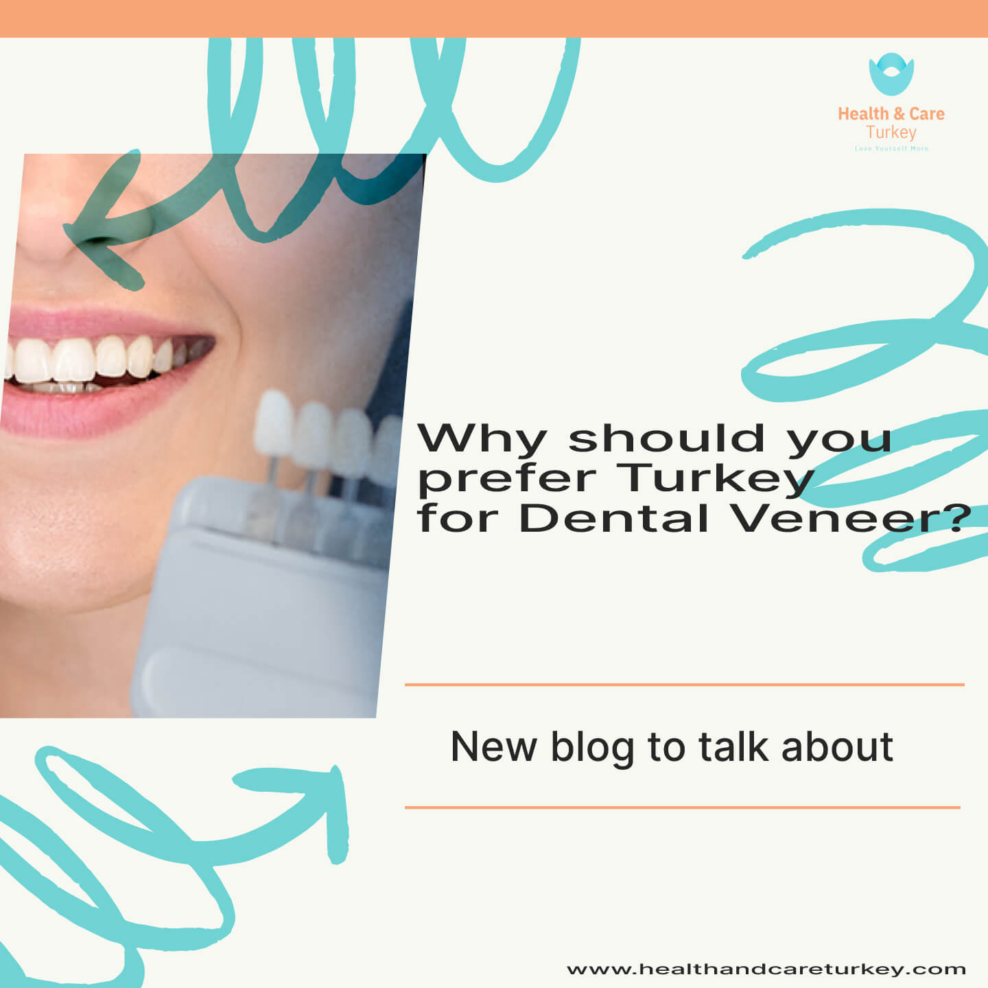 dental-veneers-in-turkey
